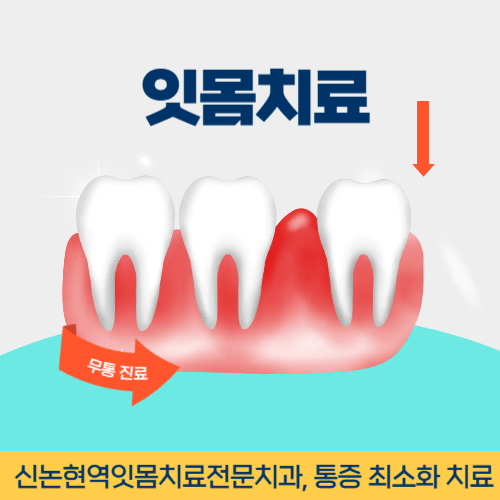 부천치과 부천역치과 잇몸치료